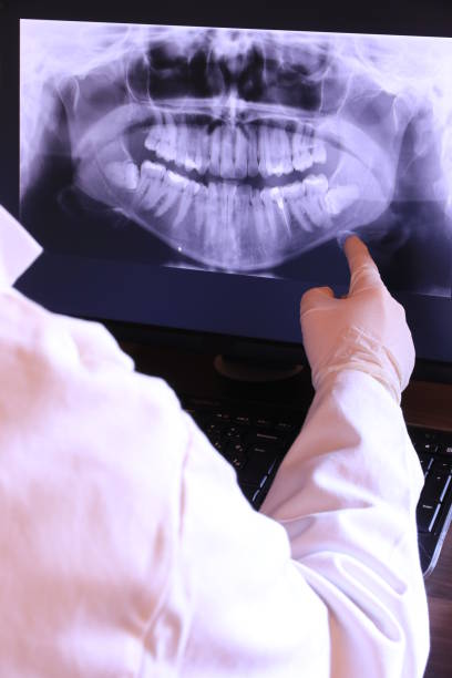 Best Emergency Treatment for Toothache in Ontario, CA